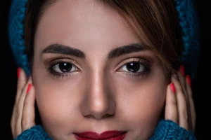 Chemical peel success stories