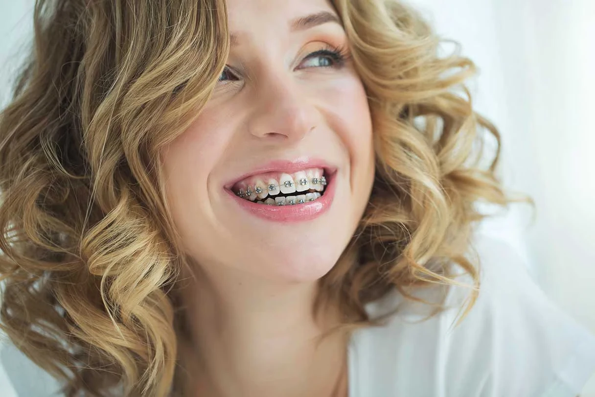 Affordable Dental Coverage for Braces for Business Owners